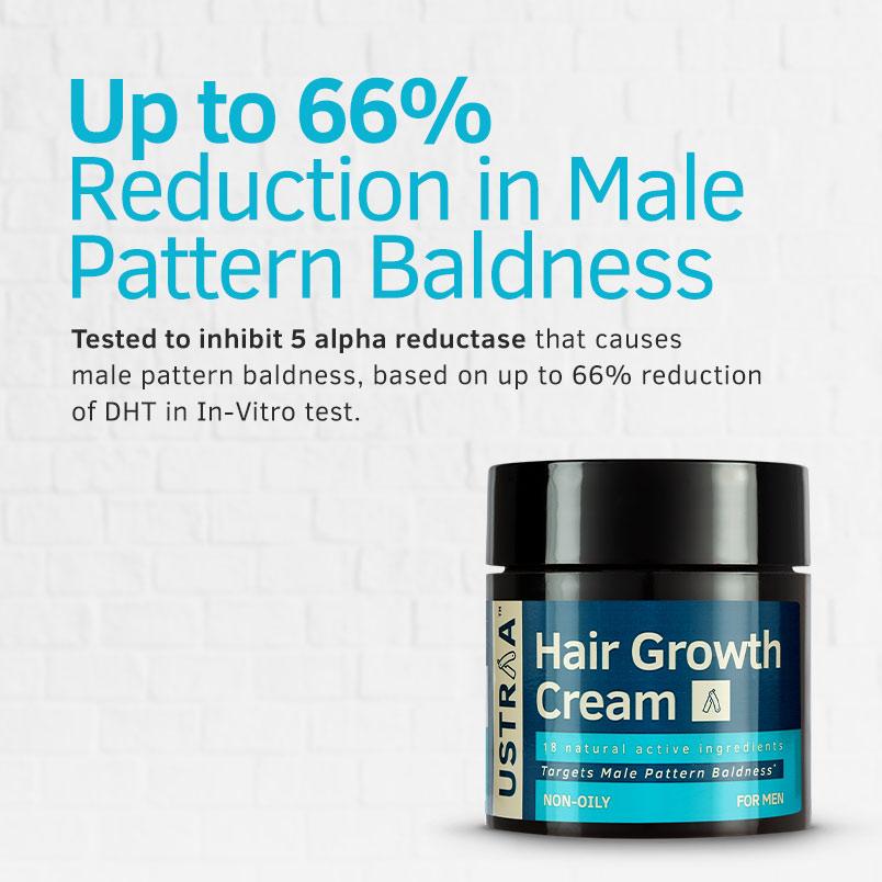 Controls Male Pattern Baldness | Hair Growth Cream | Ustraa